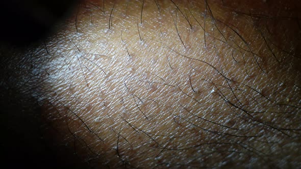Human Skin Texture