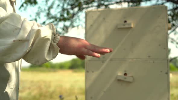 A Beekeeper with a Swollen Palm Due to a Bee Sting