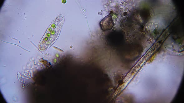 a variety of simple organisms in the aquatic environment, taken under a microscope