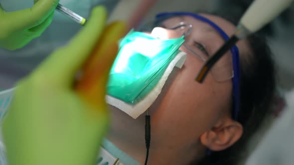 Dental Assistant Hands Leaving with UV Curing Light and Unrecognizable Dentist Inserting Filling in