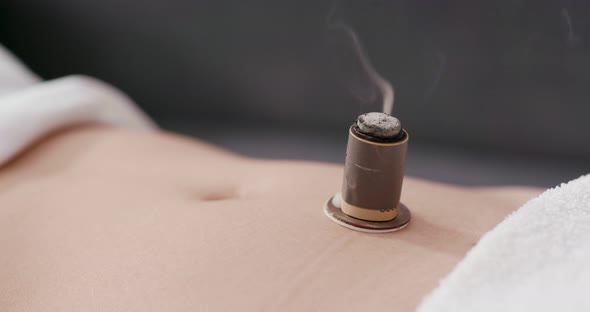 Chinese traditional medicine moxibustion therapy 