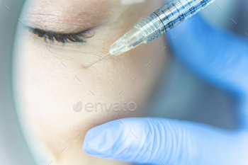 Woman is being injected around crows feet / Photodune, Misc