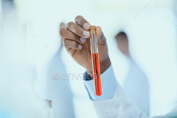Close-up partial view of scientist holding test tube with reagent, laboratory researcher concept / Photodune, Misc
