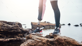 Cropped image of disabled young woman in sportswear with bionic leg / Photodune, Misc