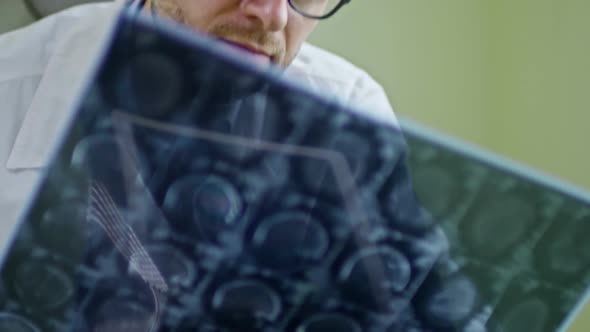 Doctor in Glasses Inspecting MRI Scan of Brain