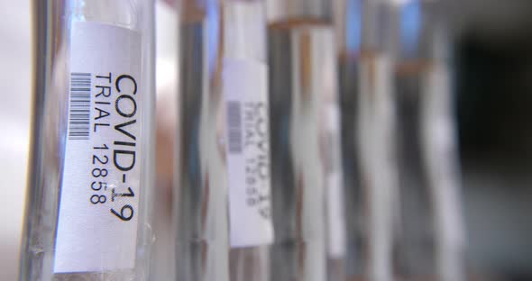 Covid 19 Test Tube Analysis