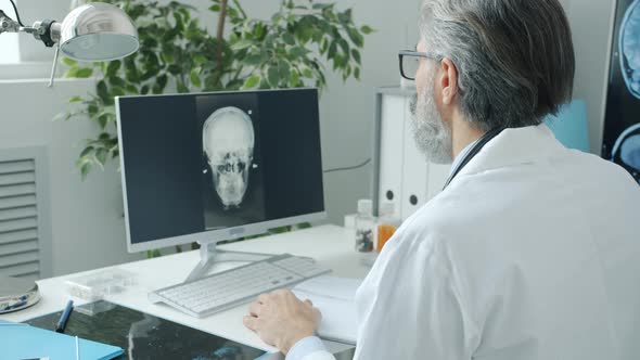 Doctor Neurologist Looking at Human Brain MRI Images on Computer Screen and Writing in Clinic