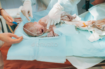 The first day of the newborn in the hospital / Photodune, Misc