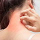 Itches Scratching Neck
