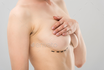 partial view of naked woman with marks under breast isolated on grey / Photodune, Misc