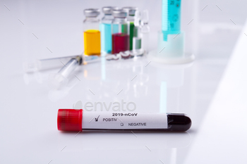 Test tube with coronavirus positive result. / Photodune, Misc