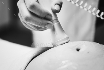 A trimester pregnant woman getting a checkup / Photodune, Misc