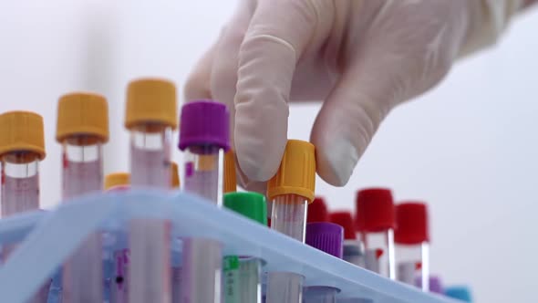 Lab Worker Wearing Medical Gloves Is Taking Test Tubes for Blood Sample Rack Dna, Close-up