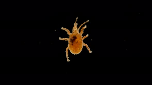 a Tick of the Order Mesostigmata Under a Microscope, Class Arachnida, Superorder Parasitiformes