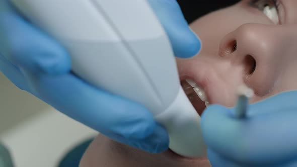 Doctor Scans the Patient's Teeth in the Clinic