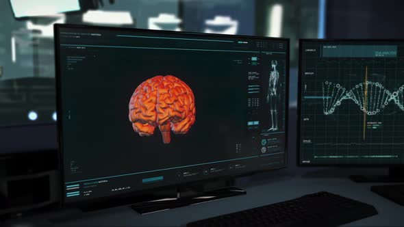 Medical software identified a brain tumor after the head analysis at laboratory alt