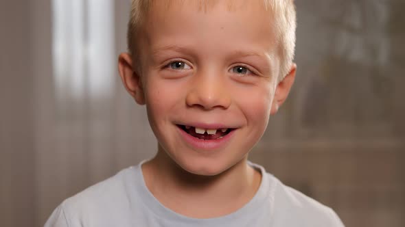 The Boy Smiles and Shows His Fallen Baby Teeth