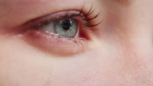 Closeup of Crying Blue Eyes Watery Eye of Young Woman Shooting of Tears Rolling Down the Cheeks
