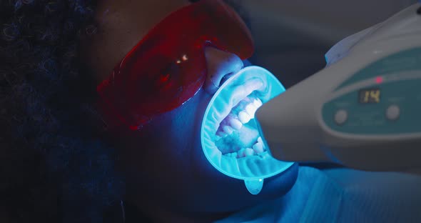 Close Up of Woman Patient Having Teeth Whitening Procedure with Ultraviolet Light Uv Lamp