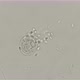 a colony of small ciliates attacked Vorticella which - VideoHive Item for Sale