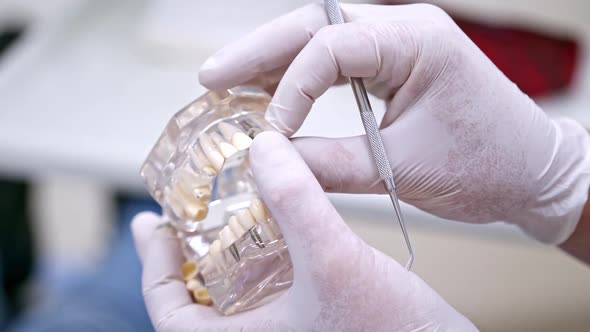 Doctor shows on a plastic jaw sample or model different methods of teeth treatment.