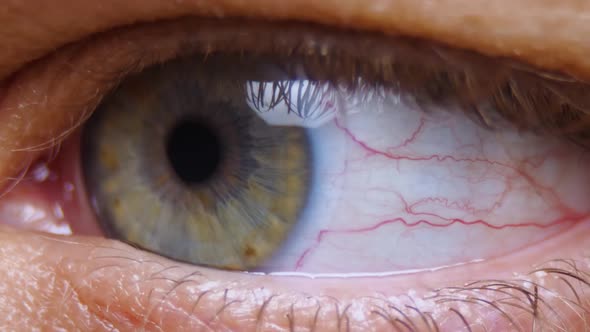 Close-up of a woman's blue eye with a contact lens. Human pupil. The eyelid blinks several times