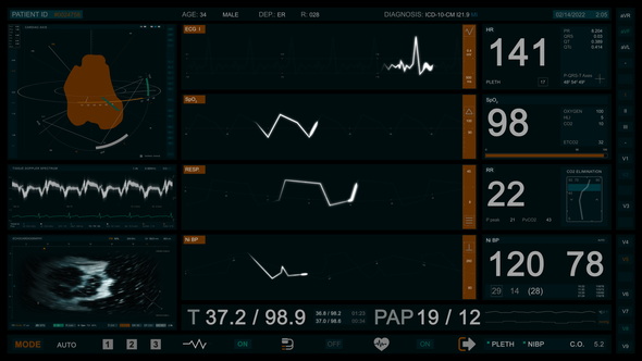 Advanced Cardiac Monitor 4K