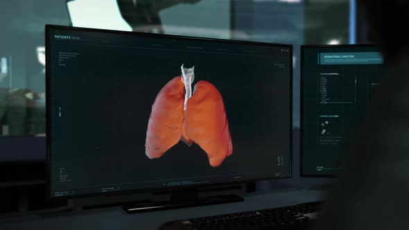 Microscopic Analysis Program Monitoring Cancer Disease Progression In Lungs alt