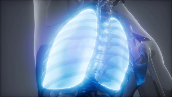 Human Lungs Radiology Exam alt