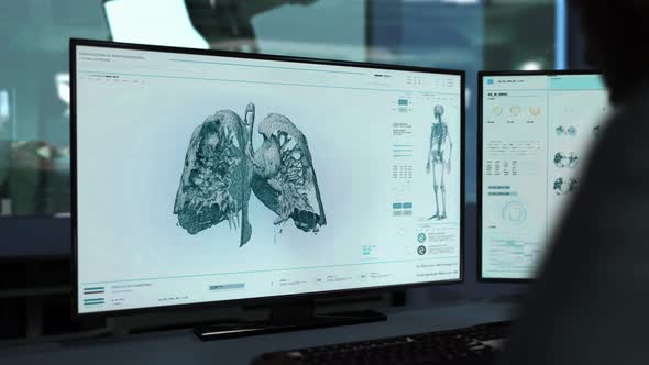 Doctor Oversees Medical X-ray Examination Scan Of Patients Lungs At Hospital