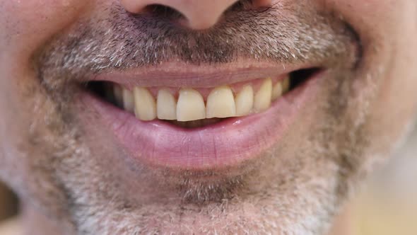 Smiling Teeth of Middle Age Man