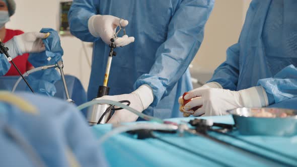 Surgeons Team During Process Operation Uterus Removal with Surgical Laparoscopy