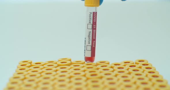 Female Hands in Blue Rubber Gloves Taking the Tube From a Rack for Test Tubes and Checking Covid-19