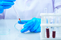 Scientist analyzing a blood sample on tray_ - PhotoDune Item for Sale