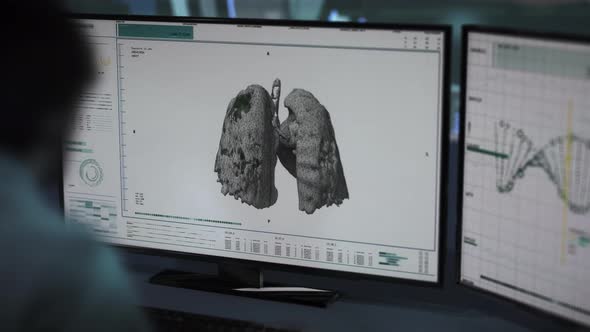 A Doctor is Supervising Lung gene Analysis and Finds Covid-19 Pneumonia Virus alt