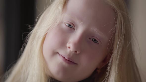Close Up Portrait of an Albino Girl with Grey Eyes Looking at the Camera Smiling. Unusual Appearance