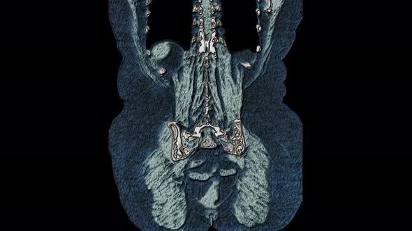 Bulk Multicolored MRI of the Abdominal Cavity, Gastrointestinal Tract, Bladder