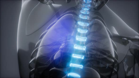 Backache in Back Bones alt