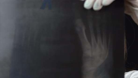 Young Woman Doctor Checks the Results of an X-ray of the Foot. A Girl Is Considering a Close-up x