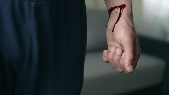 Bloody Hand of a Man with Cut Veins