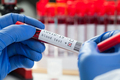 Lab scientist medical technologist labelling blood sample test tube vacutainer - PhotoDune Item for Sale