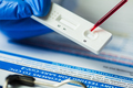 Medical laboratory technician placing blood sample specimen on quick rapid diagnostic test - PhotoDune Item for Sale
