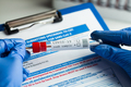 rt-PCR COVID-19 virus disease diagnostic test - PhotoDune Item for Sale