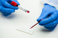 UK lab tech scientist placing blood sample on Rapid Diagnostic Test RDT cassette - PhotoDune Item for Sale
