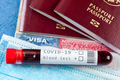 Blood sample test tube and several passports with USA American visa - PhotoDune Item for Sale
