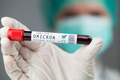 Doctor holding test tube specimen holder containing Omicron variant Coronavirus patient blood sample - PhotoDune Item for Sale