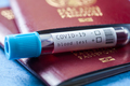 COVID-19 test tube and red passport - PhotoDune Item for Sale