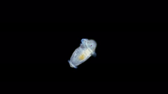 Larva of a worm at metatrochophore stage under a microscope, of family Pectinariidae