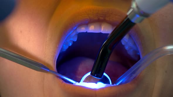Dental Patient and Curing Light.