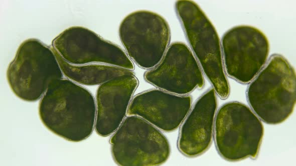 Flatworm Typhloplana Sp. Under a Microscope, the Typhloplanidae Family, Rhabditophora Class, Lives